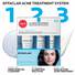 Effaclar Acne Treatment System
